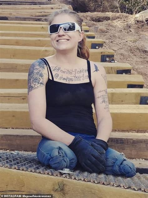 Woman 26 Who Lost Both Of Her Legs Captures Hearts With Her Cheeky