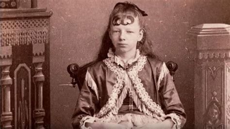 Josephine Myrtle Corbin The 4 Legged Woman Her Story Facts And