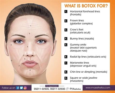 Botox Usage Efficacy Cost And More Healthline Botox Lip
