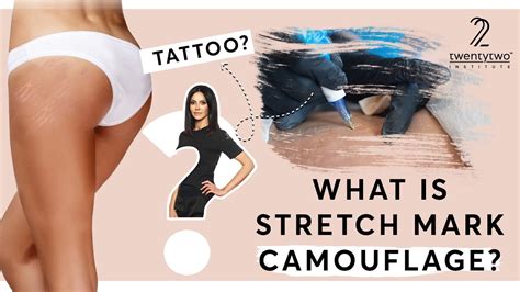 All About Stretch Mark Camouflage Stretch Mark Camouflage Online