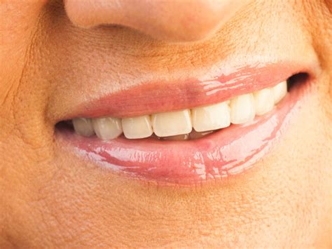 18 Natural Remedies To Remove Dark Ring Around Mouth