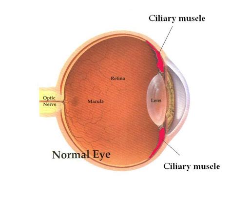 Myopia Cause And Prevention