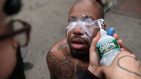 Baltimore Protests Experts Caution Against Using Milk Antacid To Wash