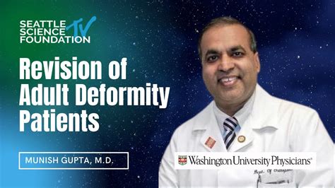 Revision Of Adult Deformity Patients Munish Gupta M D Youtube