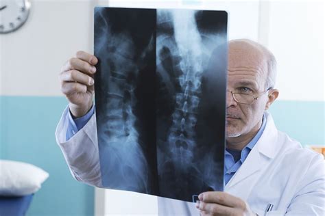 Spinal Stenosis When Is Surgery The Best Option Spinal Stenosis