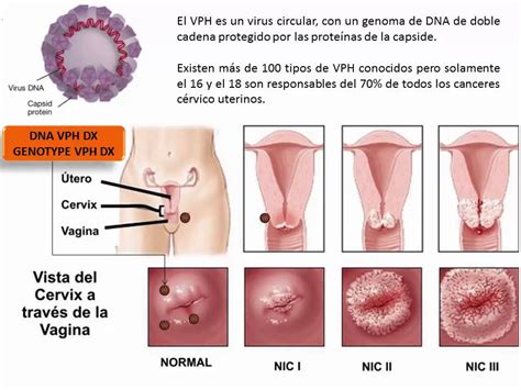 Papiloma Humano Youtube