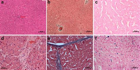 Histological Evaluation Of Liver From Normal And Fibrosis Model H E