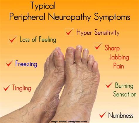 What Is Neuropathy Know Its Risk Factors And Treatment