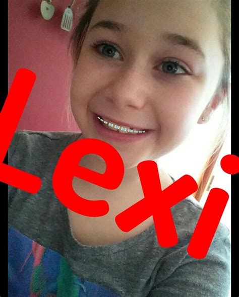 Braces With Lexi Beautiful Pictures Beautiful Pretty