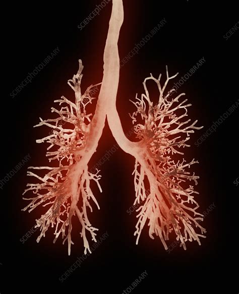 Lung Airways Stock Image P5800127 Science Photo Library