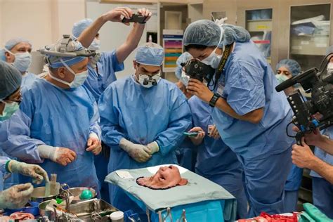 Face Transplant Surgery Primary Anatomy