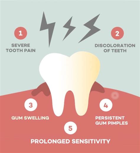 What Are The Signs And Symptoms Of Tooth Needing Root Canal Treatment Dr Bharat Katarmal