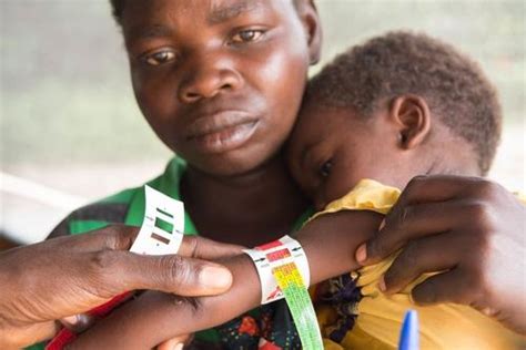 Drc Children Who Survived Measles Are Now Suffering From Malnutrition