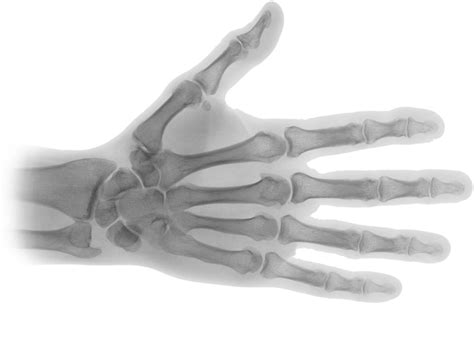 X Ray Png Png Image Collection