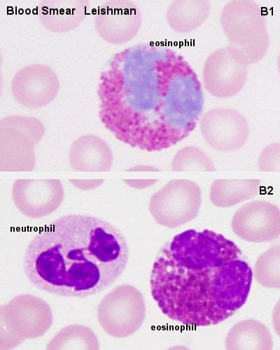 Eosinophils And Basophils Diagram Bing Images Hematology Bing