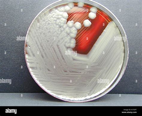 Bacillus Cereus Montrant Une Hémolyse Sur Gélose Au Sang De Mouton B
