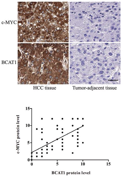 Immunohistochemical Staining Of Bcat1 And C Myc In Hcc And Matched