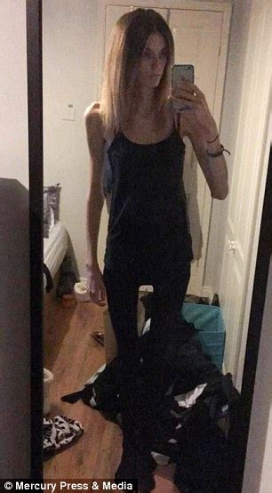 Forest Town Anorexia Survivor Reveals How She Turned Her Life Around