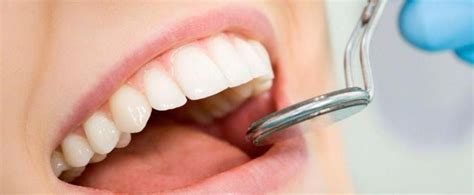 How much does wisdom tooth removal cost? Scintillating Tooth Extraction Healing Homemade Toothpaste #toothgemsdija #ToothExtractionAf ...