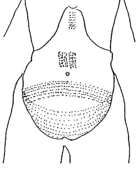 We did not find results for: Detail of the abdominal tattoos visible on a Dynasty XI mummy of Amunet... | Download Scientific ...