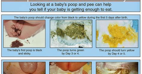 Dr Mom Always On Call Decoding The Infants Rainbow Of Poop Why Is