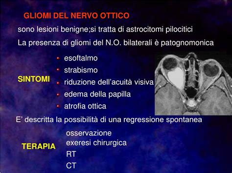 Edema A Mantellina E Esoftalmo - PPT - FACOMATOSI E OCCHIO PowerPoint Presentation, free download - ID