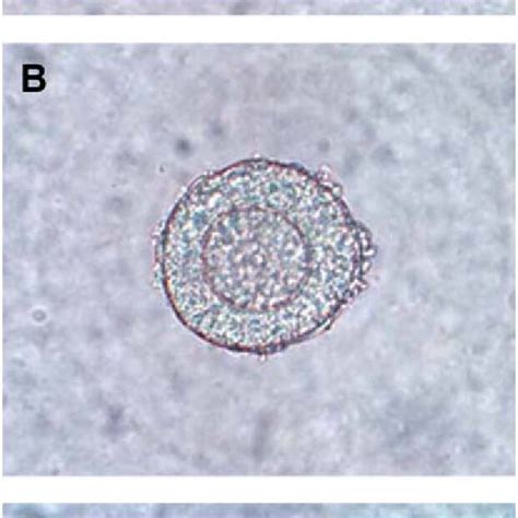 Classification Of Preantral Follicles At Retrieval A The Primary