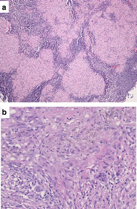 Histology Of Lymph Node