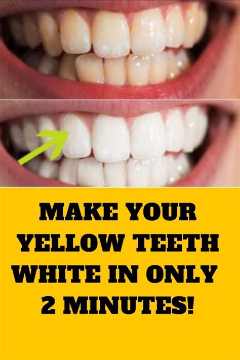 Teeth Treat How To Make Teeth Really White