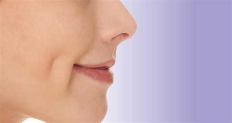 Get Perfect Dimples With Dimpleplasty In Pune