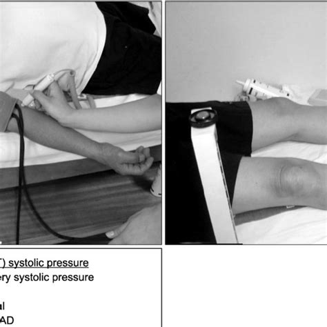 Definition And Measurement Of The Ankle Brachial Index Abi