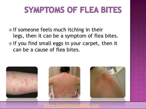 Superdrug Health Clinic Flea Bites Cure