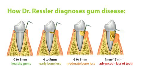 Pros And Cons Of Laser Gum Surgery Vs Traditional Gum Disease Treatmnent