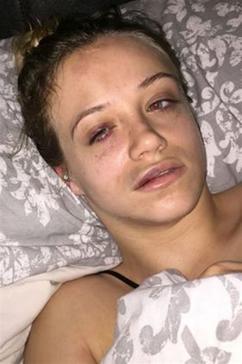 Young Woman Suffers Brutal Injuries In Her Own Home After Gang Viciously Beat Her And Loot