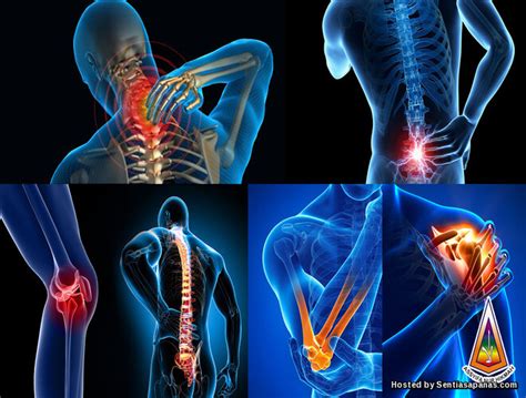 Sakit tulang belakang adalah nyeri yang terjadi pada dari ruas tulang belakang. Punca Sakit Tulang Belakang Ketika Bangun Tidur ...