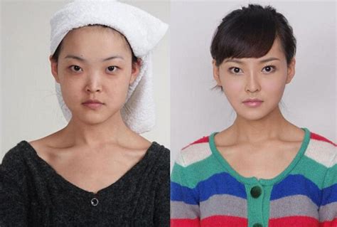Plastic Surgery Is Popular In Asia 19 Pics
