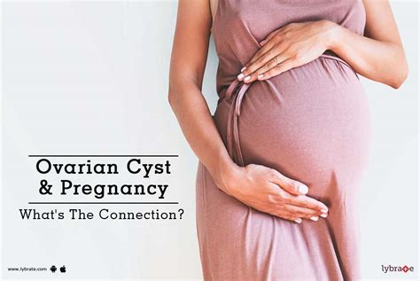 Ovarian Cyst And Pregnancy Whats The Connection By Dr Laqa Sultan