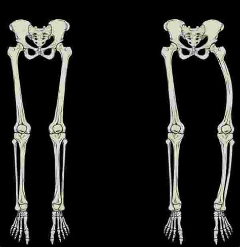 These can include any the following: Bone Structure | Anatomy and Physiology I