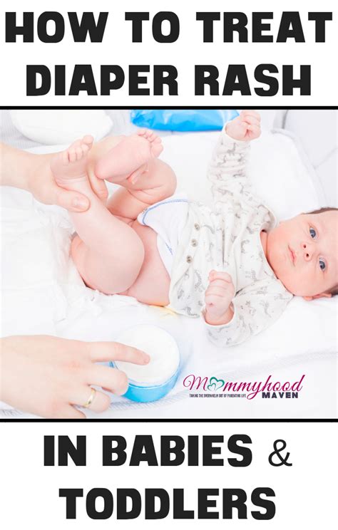 How To Treat Diaper Rash In A Newborn Baby Diaper Rash Baby Bottoms