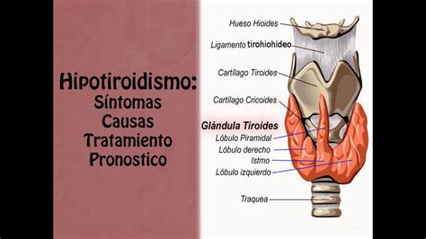Hipotiroidismo Síntomas Causas Tratamiento Y Pronostico Youtube