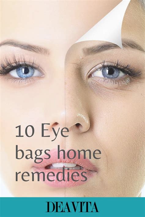 10 Eye Bags Home Remedies That Will Help You Get Rid Of Them Eye Bags Home Remedies Reduce