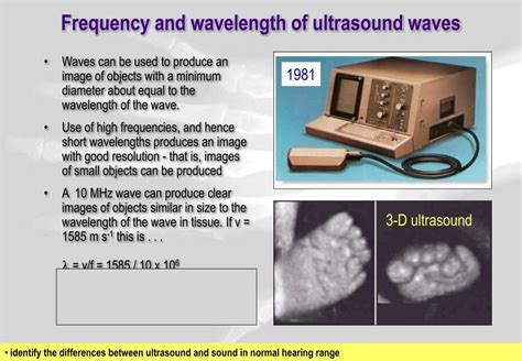 Ppt Medical Physics Ultrasound Powerpoint Presentation Free Download