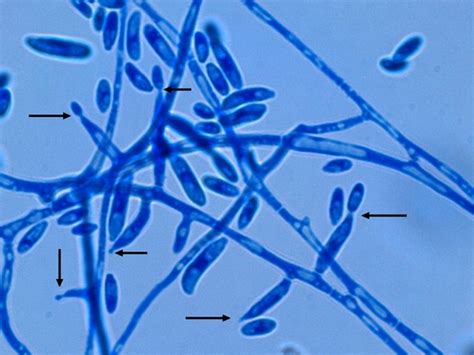 Fun With Microbiology Whats Buggin You Fusarium Oxysporum