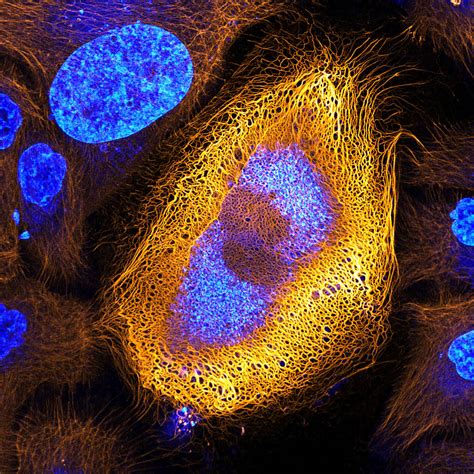 Stunning Microscopic View Of Human Skin Cells Wins Nikon Small