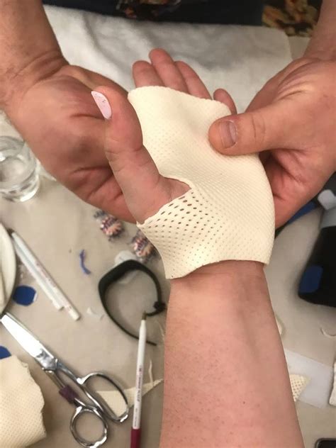 Right Hand Therapy Live Orthotic Fabrication Course Michigan