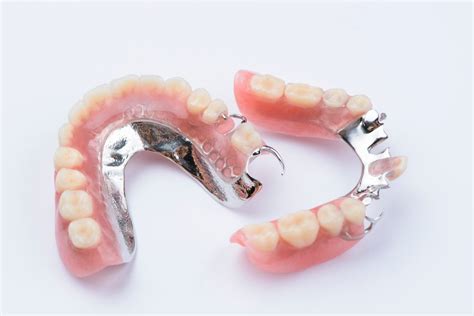 Partial Dentures Piedmont Dental Associates