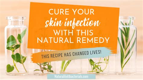 Natural Remedy For Staph Infection A Diy Topical That Works Natural