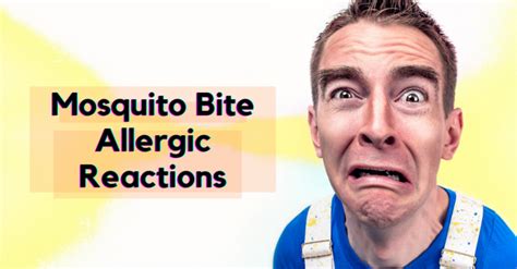Then, when biting you, the mosquito can transfer that virus or parasite to you through its saliva. Mosquito Bite Allergic Reactions - Pest Survival Guide
