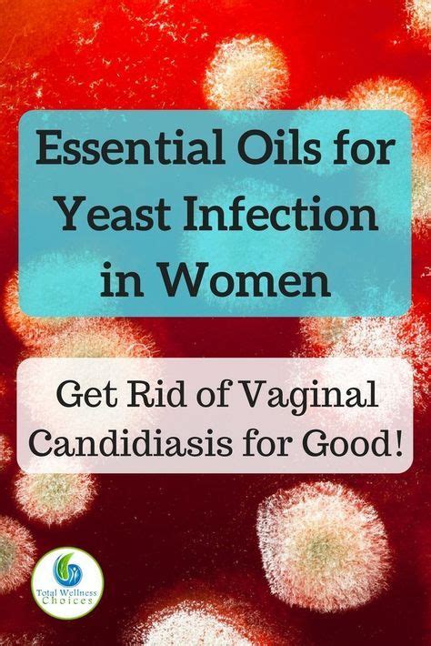 7 Essential Oils For Yeast Infection In Women With Images Yeast Infection Treatment Yeast