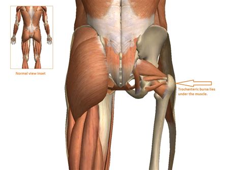 These muscles include the gluteus medius, gluteus minimus, and tensor fasciae latae. Trochanteric Bursitis and Hip Pain - Innova Pain ...